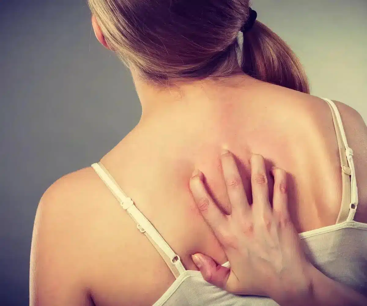 side-effects-of-codeine-1536x1150 (2)