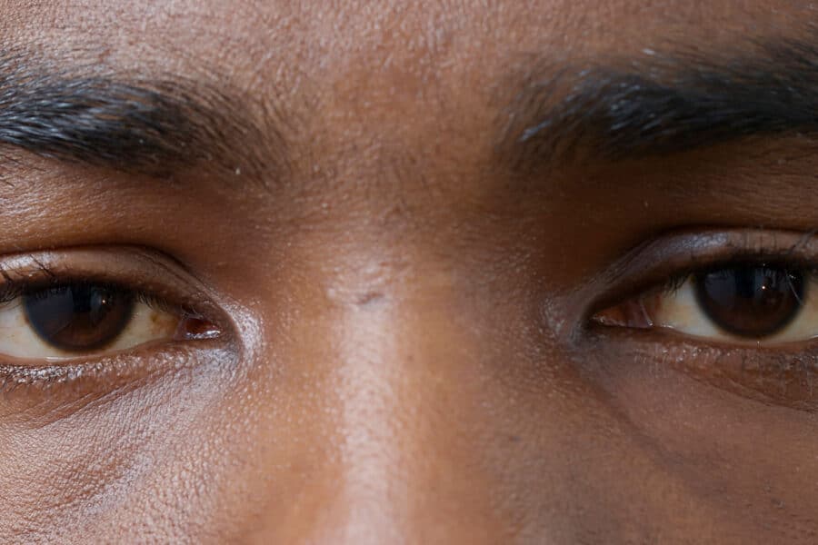 Pupil dilation occurs naturally with light changes and emotions, but many drugs can also cause enlarged pupils.