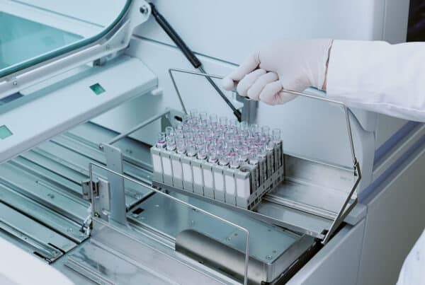 Blood tests can identify Percocet for a shorter time than other types of drug testing.