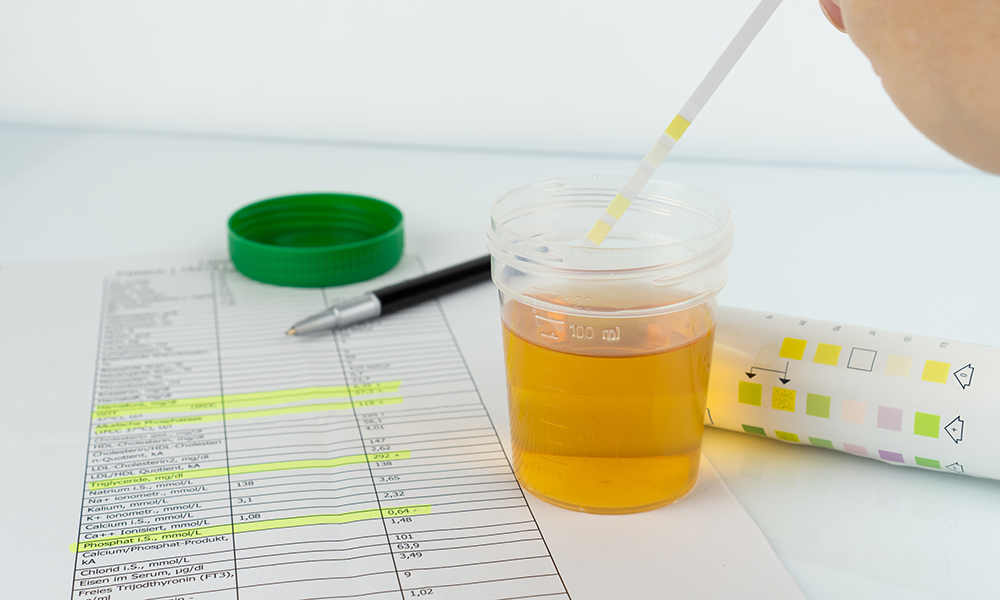 Kratom is more commonly tested for in urine